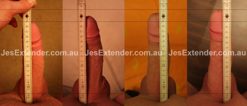 Jes Extender before and after picture (2)